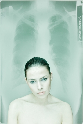 加拿大Radiograph人像X光片图片