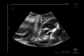 Santa Casa圣诞老人之家-献血B超平面广告