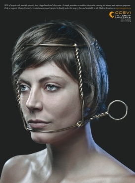 国外CCSVI in Multiple Sclerosis多发性硬化症平面广告