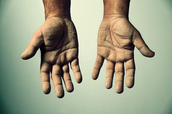 Advertising Awards广告奖-马德里Ángel Álvarez摄影师作品图片