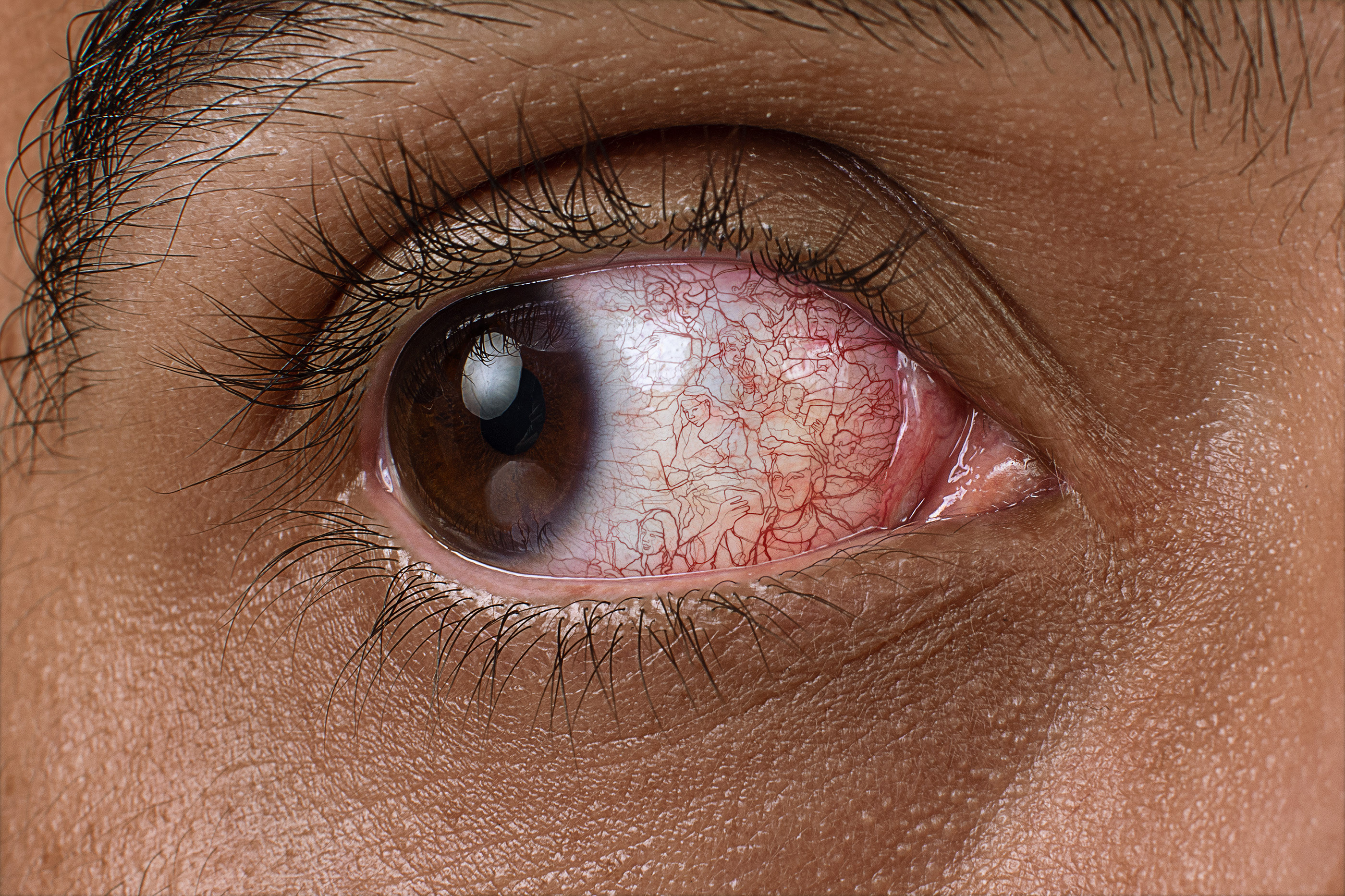 眼睛经常充血是肝的问题吗，眼睛有红血丝是和肝火有关系吗？