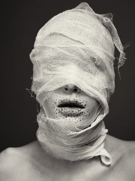 被纱布包裹的女孩