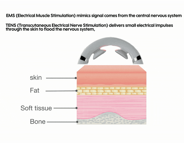 可产生内啡肽以减轻疼痛的WFH颈部按摩器---酷图编号8