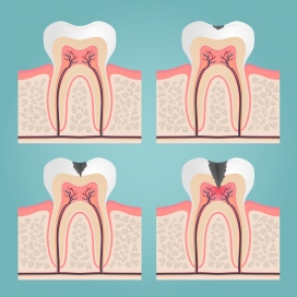 牙龈牙根横切面素材