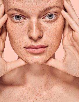 pogorela-雀斑女子