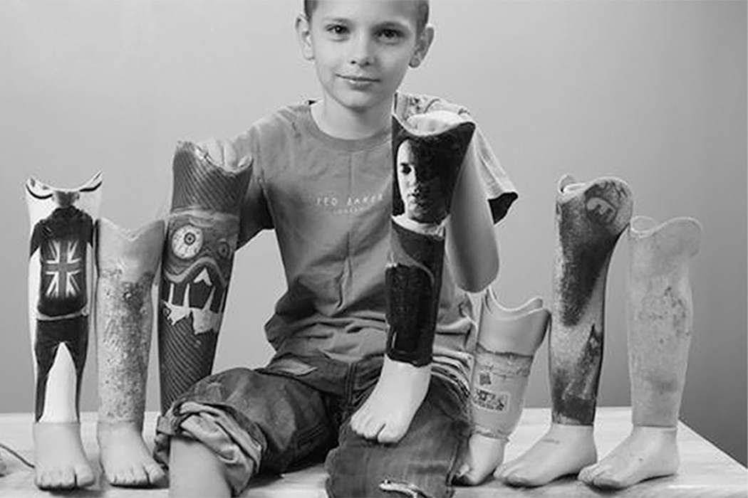 可以陪腿不方便朋友一起成长的假肢---酷图编号7