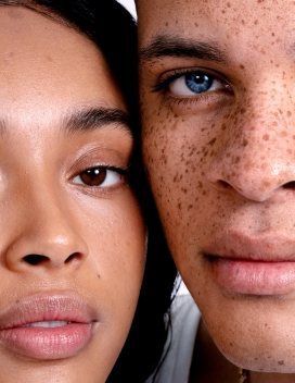 骄傲美丽的皮肤运动 II