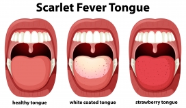 卡通口腔舌头舌苔牙齿素材