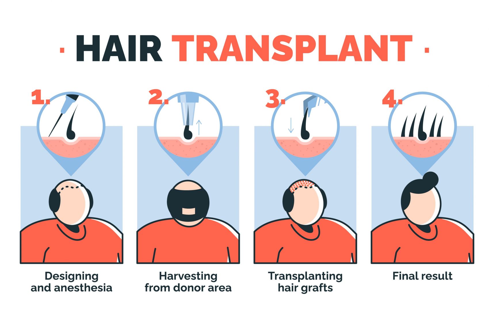 卡通四款毛发移植插图素材图片
