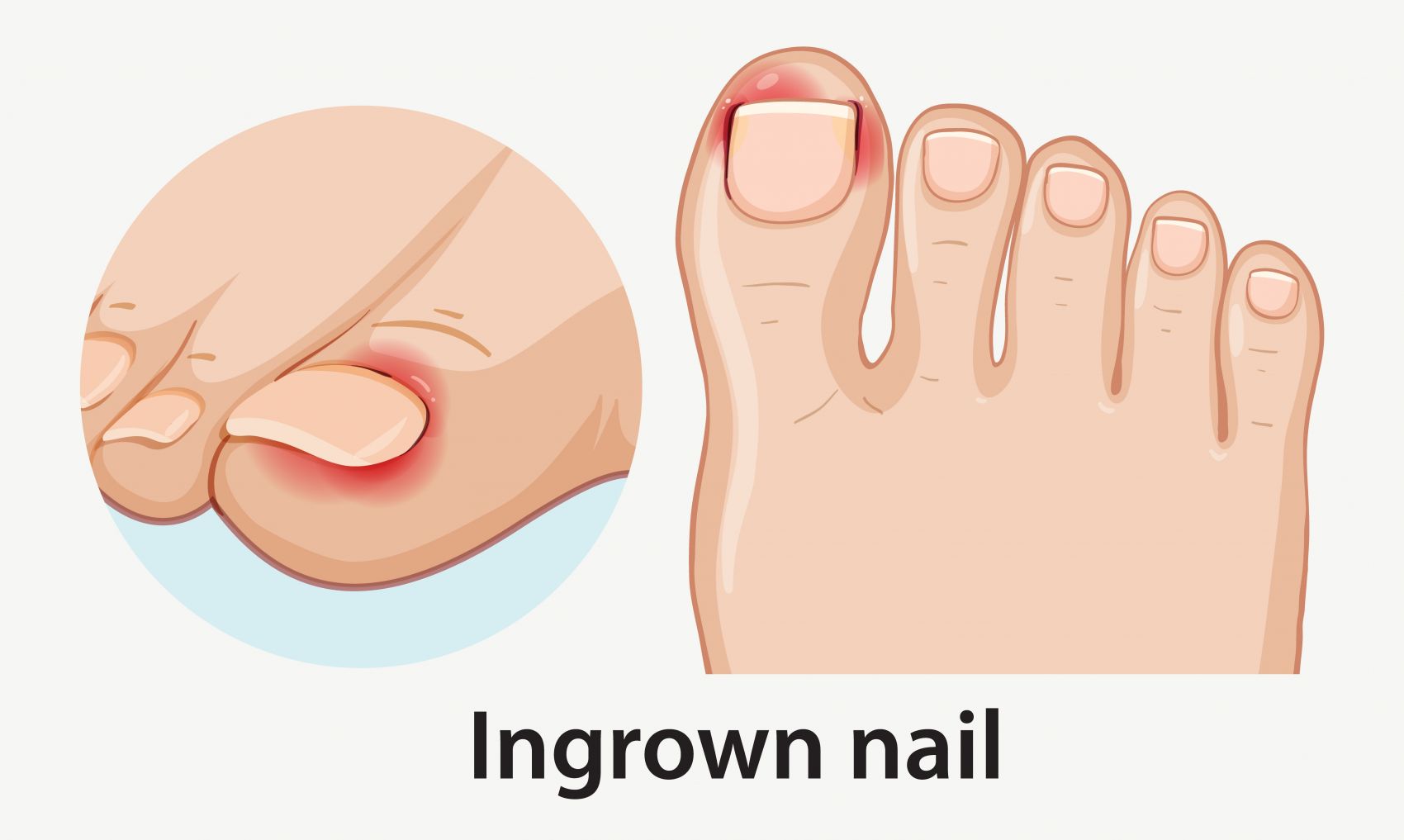 卡通嵌甲人脚的矢量插图图片