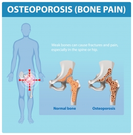 卡通骨质疏松性骨痛素材