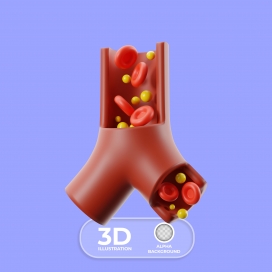 胆固醇甘油三酯脂质剖面图